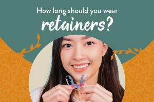 how long to wear retainers