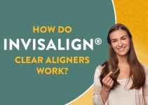 how clear aligners work